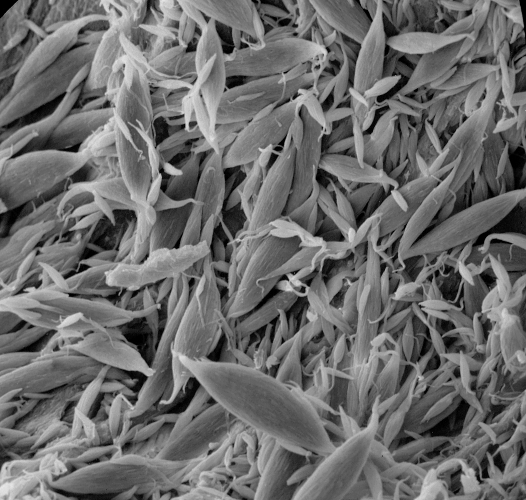 Spermatozeugmy w aspermatogenicznej czesci jdra Mimagoniates barberi. Mikroskop elektronowy skaningowy