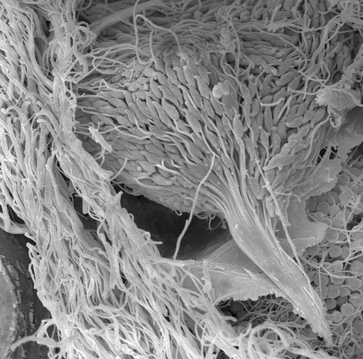 Biegunowy ukad spermatyd w kocowej fazie spermiogenezy u Glandulocauda melanogenys