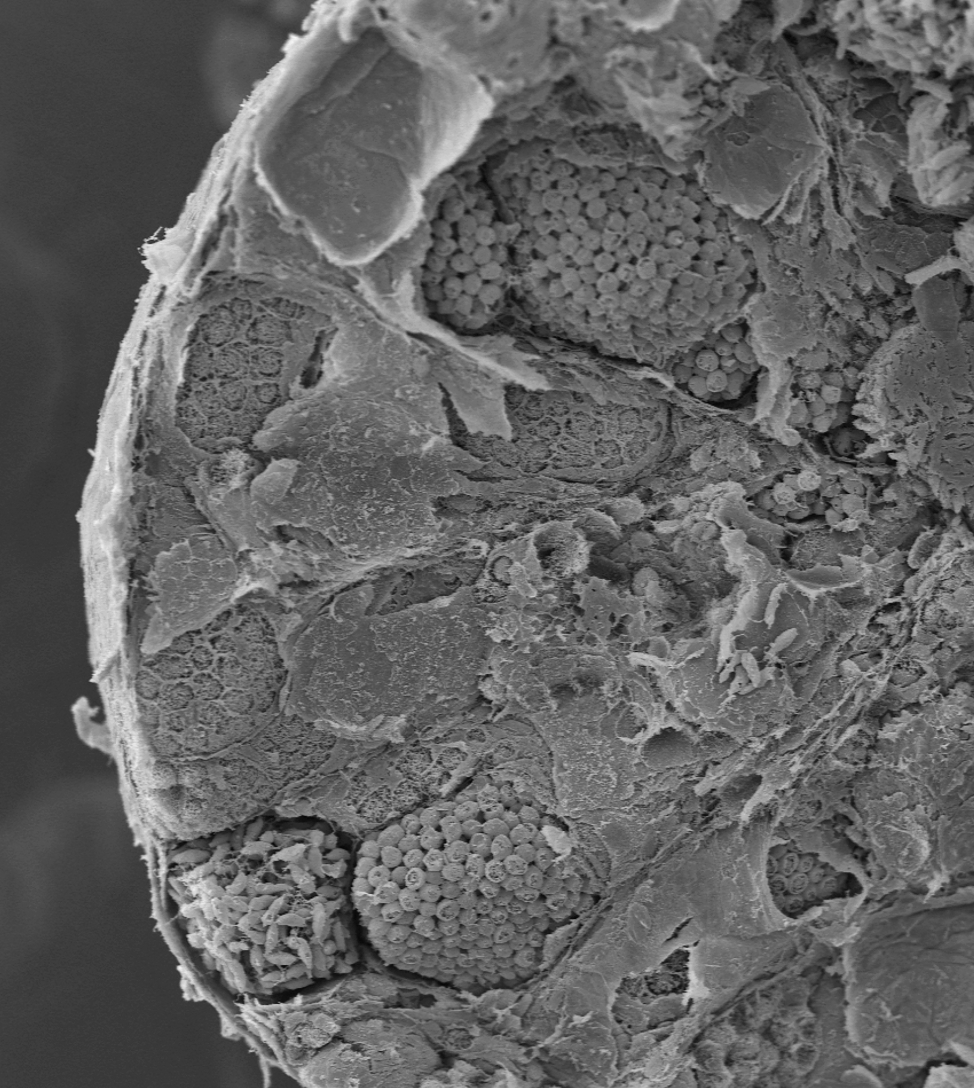 Rozam fragmentu jdra kumaka grskiego Bombina variegata obrazujcy cysty zawierajce  komrki w rnych stadiach spermatogenezy